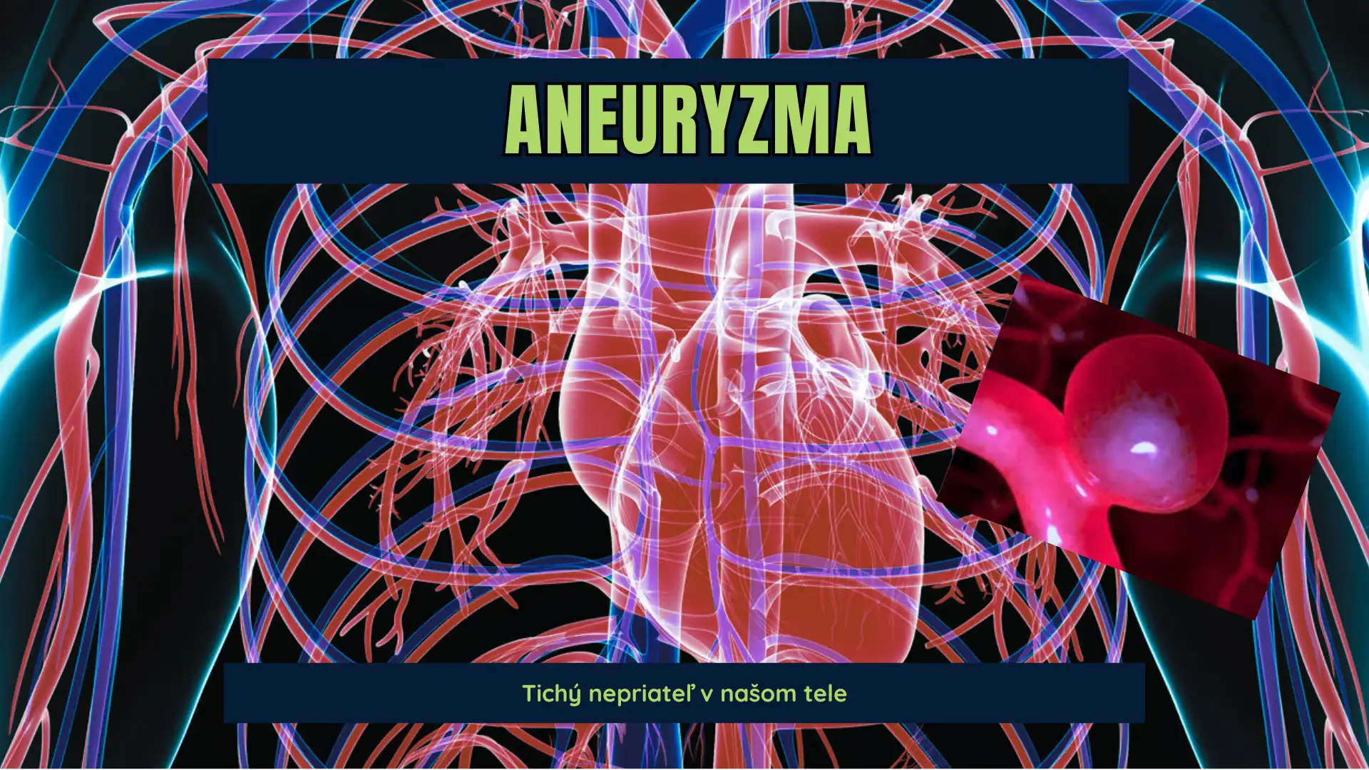 Aneuryzma- Tichý nepriateľ v našom tele